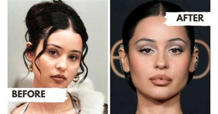 Alexa Demie Before Surgery Photos: Fans Suspect That She Underwent Lip Augmentation Procedure