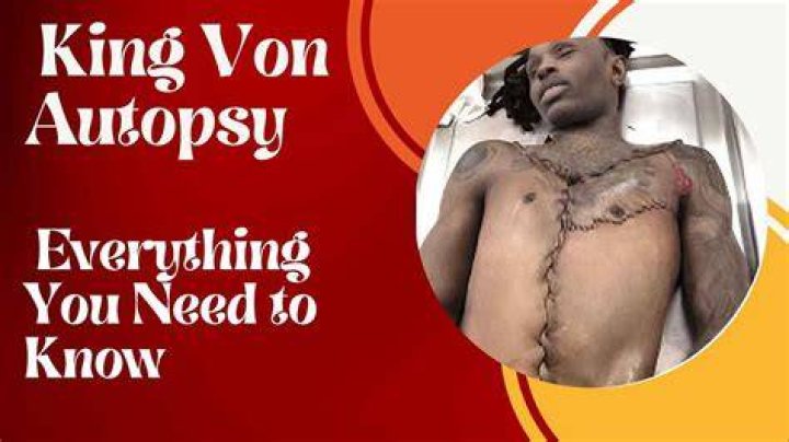 Behind The Scene: Uncovering The Autopsy Of Chicago's King Von
