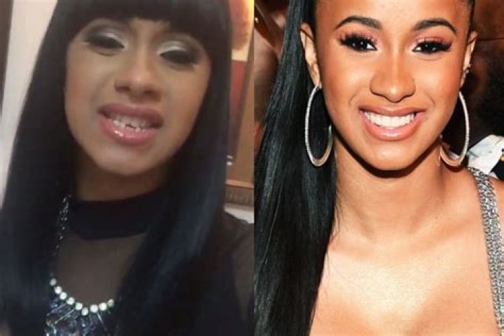 Cardi B’s New Teeth Costs $40k – Before and After Pictures of Smile Makeover | Dr. Catrise Austin is The Dentist