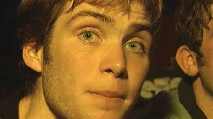 Cillian Murphy's Unseen Battle: The Lump Behind His Right Ear