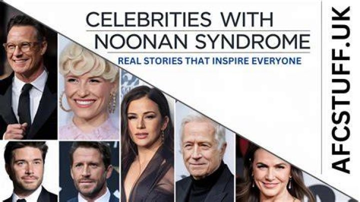 Courage And Resilience: Celebrities With Noonan Syndrome