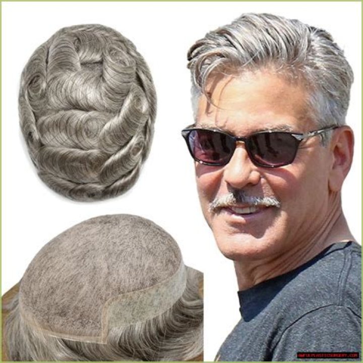 Did mannix wear a toupee