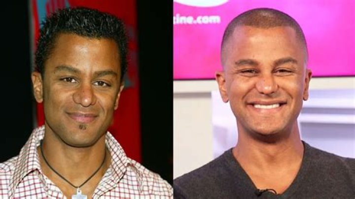 Did Yanic Truesdale Ever Undergo Plastic Surgery? Gilmore Girls Actor Surrounded By Rumors
