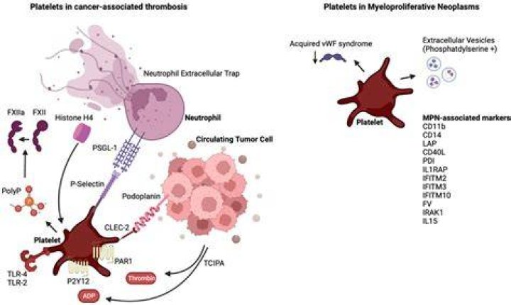 Embracing Life: Navigating Living With Essential Thrombocythemia