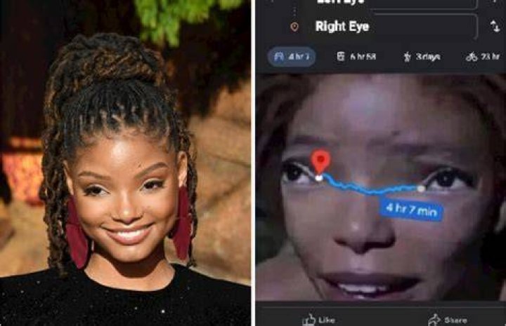 Exploring The Truth: Does Halle Bailey Have A Disability?