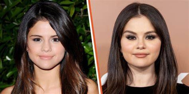 Has Jenna Coleman Done Nose Job? Before And After Photos Of The Actress