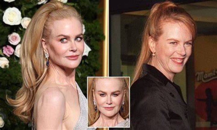 Has Nicole Kidman Had A Boob Job? Unraveling The Truth Behind The Rumors