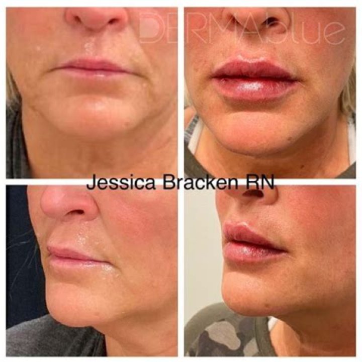 Has Tisha Campbell Done Plastic Surgery? Fans Suspect Lip Fillers And Botox!