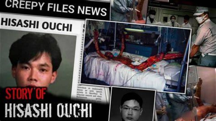 Hisashi Ouchi: A Journey Through His Final Days