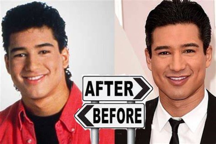 Is Courtney Mazza’s Husband Mario Lopez Plastic Surgery Rumors True?