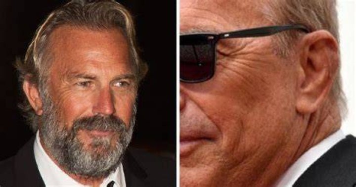 Is Kevin Costner Missing Part Of His Ear? Surgery and Left Ear Condition Update