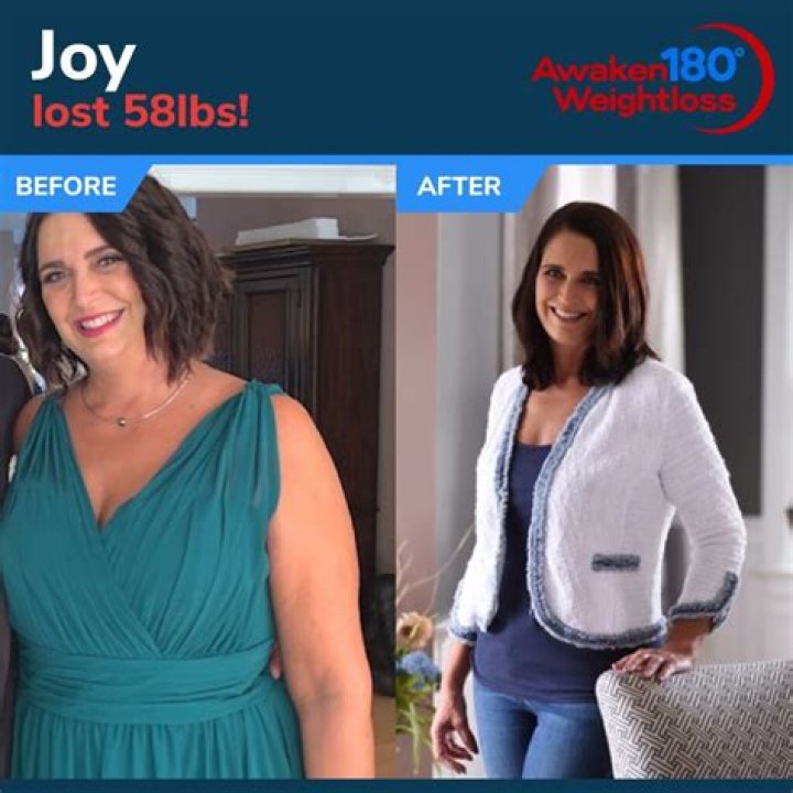 Joyce Vance Makeover: Has She Had A Neck Surgery?