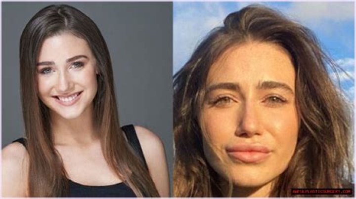 Kamilla Kowal Plastic Surgery: Does She Have A Lips Injections?