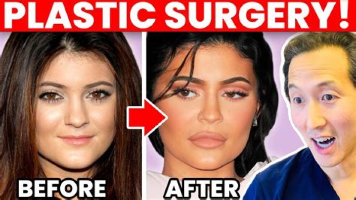 Kiaraakitty Drama Explained – Before Plastic Surgery, Age and Boyfriend