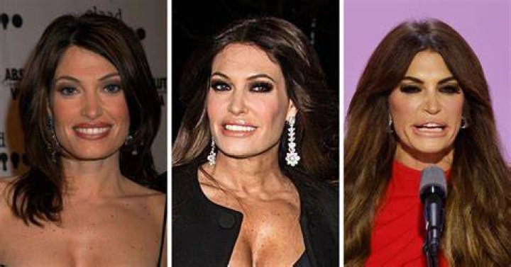 Kimberly Guilfoyle's Stunning Transformation: A Deep Dive Into Her New Look