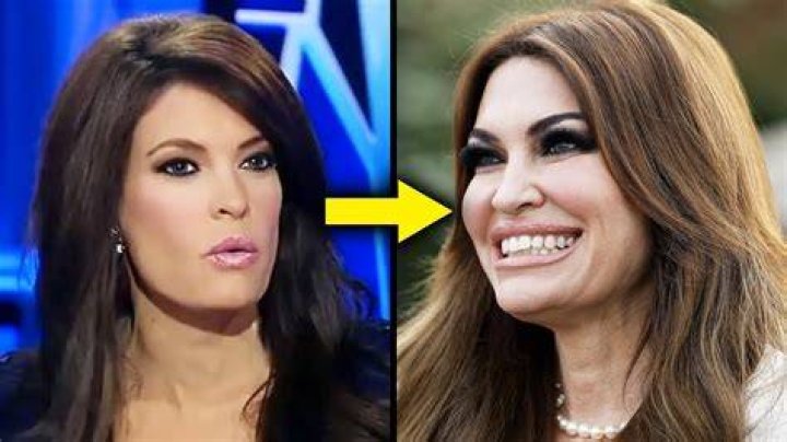 Kimberly Guilfoyle's Transformation: From Controversial Attorney To Trump's Fiery Ally