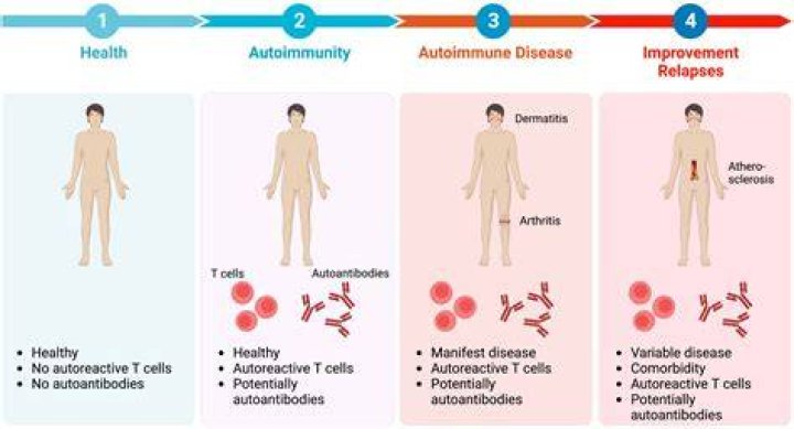 Lupus Ozempic: Navigating The Intersection Of Autoimmunity And Diabetes Treatment