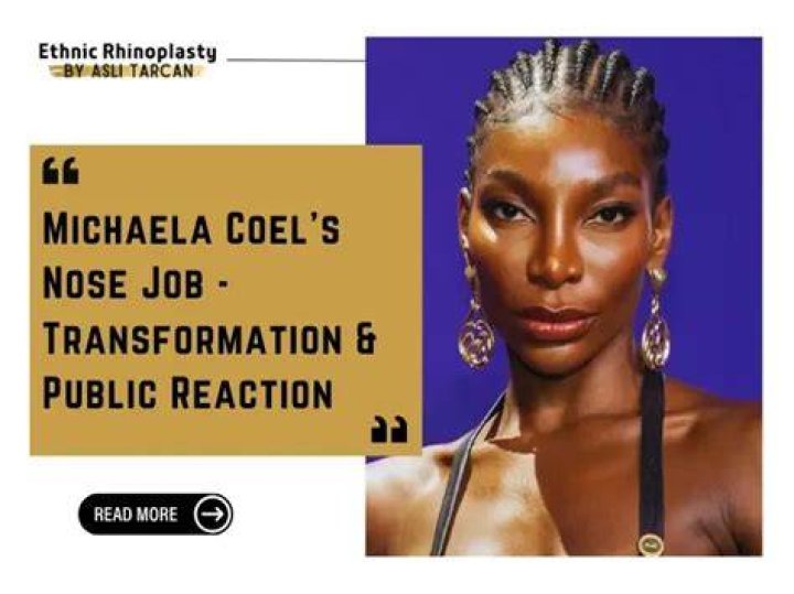 Michaela Coel's Transformation: The Nose Job Debate