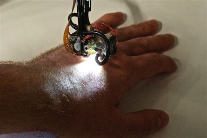 MIT's Skinbot is a Wearable Robot Designed to Scamper Over Your Body