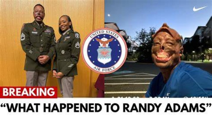 Randy Adams' Tragic Face Accident: A Shocking Account