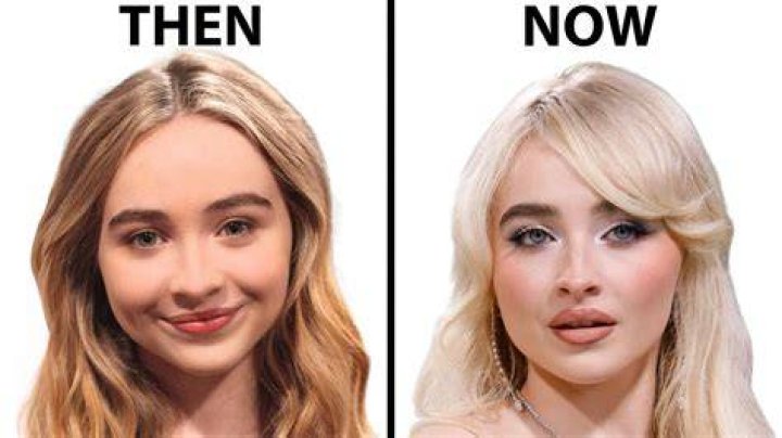 Sabrina Carpenter's Lip Injections: The Transformation Journey