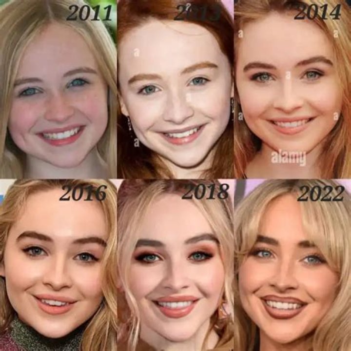 Sabrina Carpenter's Transformation: Before And After Filler