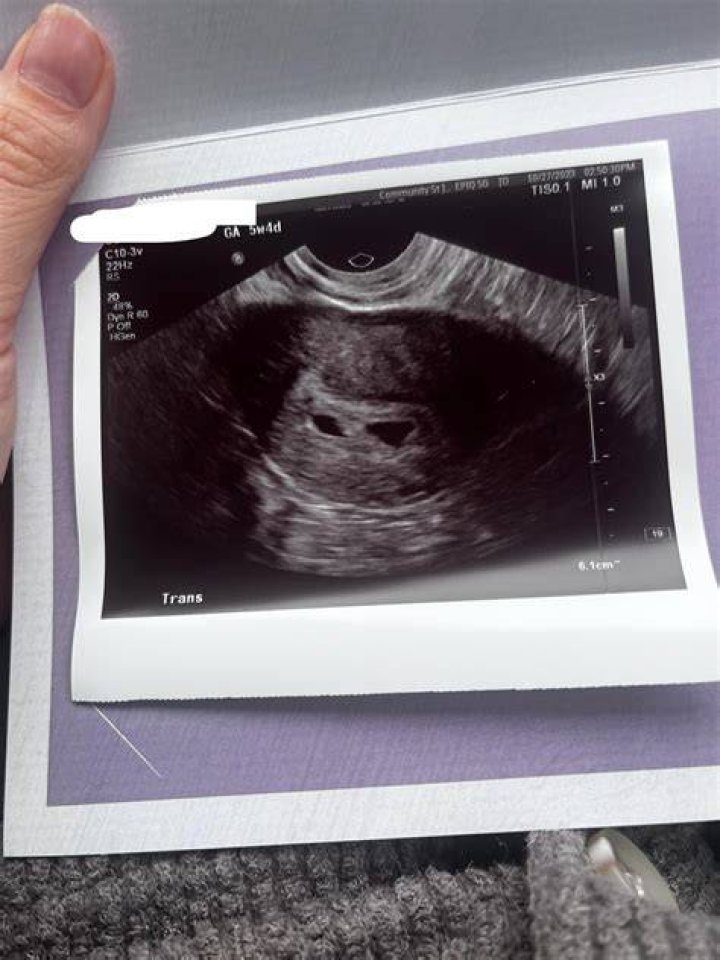Sylvia Jefferys Pregnant At 12: Where Is She Now?