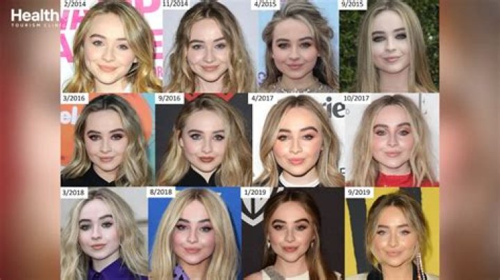 The Unfiltered Truth About Sabrina Carpenter's Plastic Surgery Journey