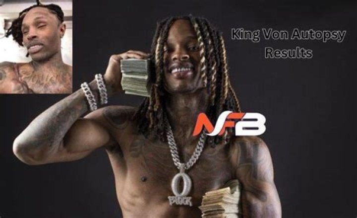 Tragic Aftermath: King Von Autopsy Photos Released | Exclusive