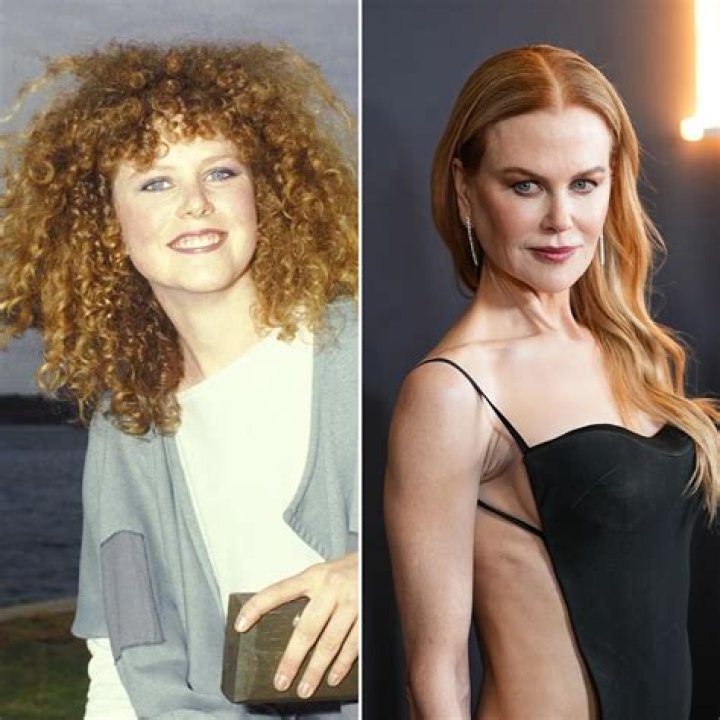 Transformations And Revelations: Nicole Kidman After Plastic Surgery