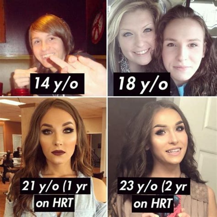 Transgender Youtuber Blaire White Before and After Transition Pictures, Was She Born As A Boy?