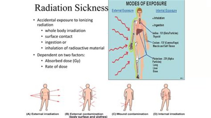 Understanding Acute Radiation Syndrome Through Pictures