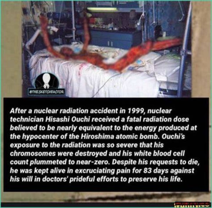 Unraveling The Hisashi Nuclear Accident: A Reflection On Safety And Responsibility