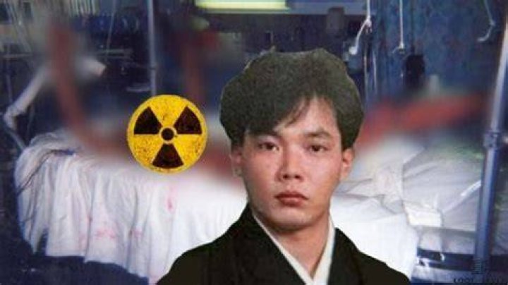 Unraveling The Tragic Tale Of Hisashi Ouchi's Body After Radiation Exposure
