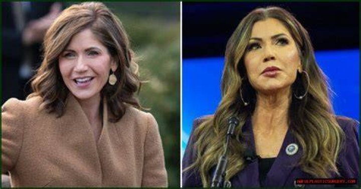 Unveiling The Authenticity: Kristi Noem Without Makeup
