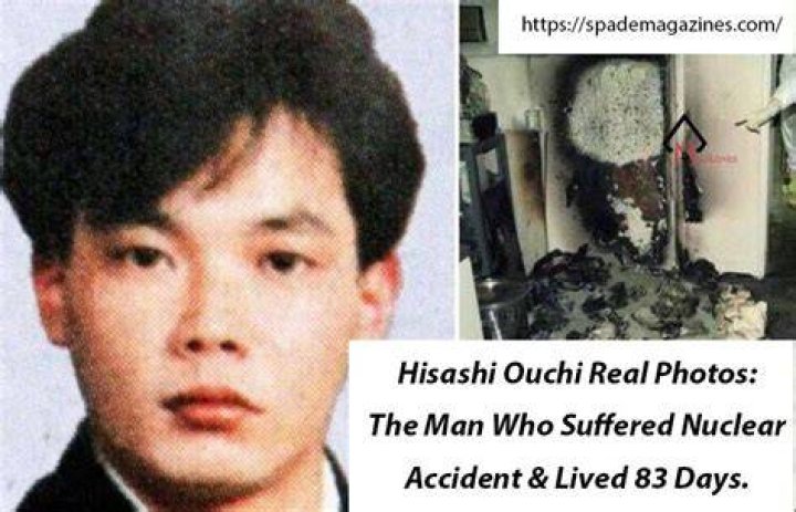 Unveiling The Life And Legacy: Photos Of Hisashi Ouchi