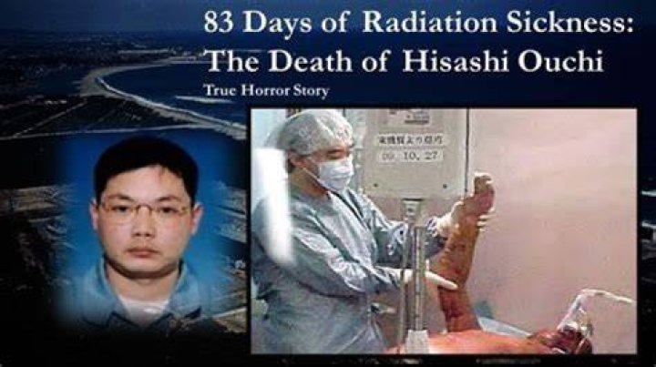 Unveiling The Mystery Behind Hisashi Ouchi's Death Photo