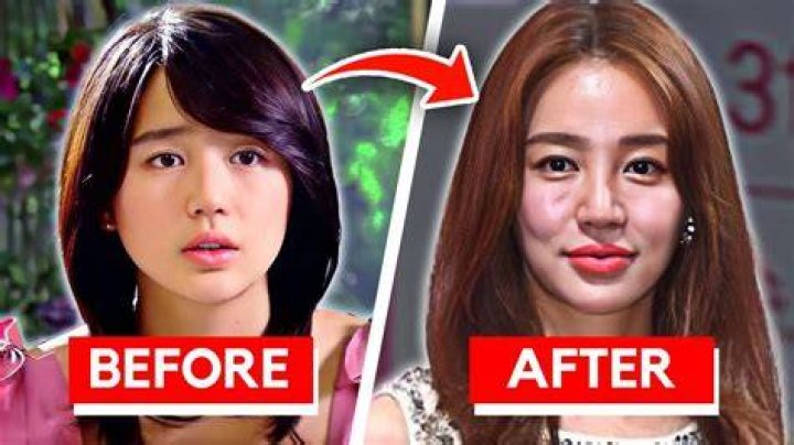 Unveiling The Transformation: Kim Ji-won Before Surgery