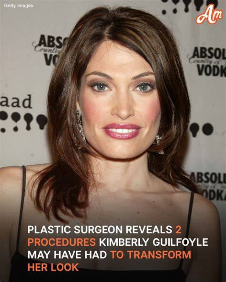 Unveiling The Transformation: Kimberly Guilfoyle Before Surgeries