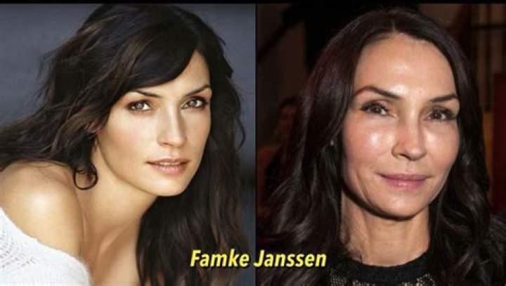 Unveiling The Truth Behind Famke Janssen's Plastic Surgery Journey