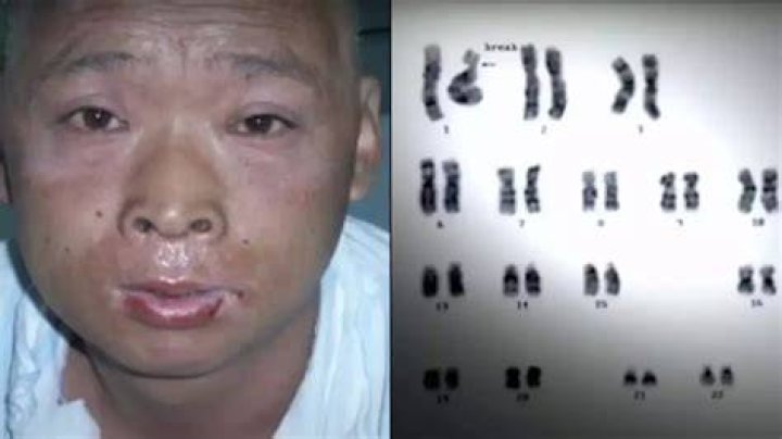 Unveiling The Truth Behind Hisashi Ouchi's Skin Photo