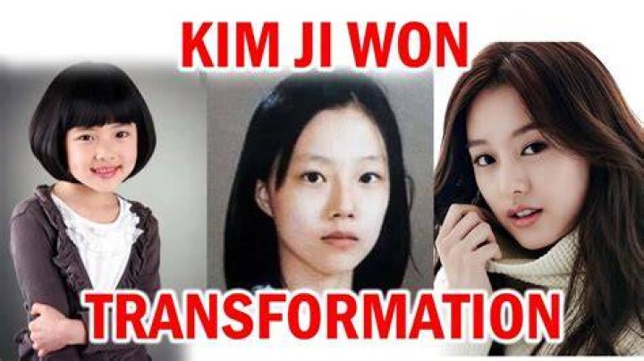 Unveiling The Truth Behind Kim Jiwon's Plastic Surgery Journey