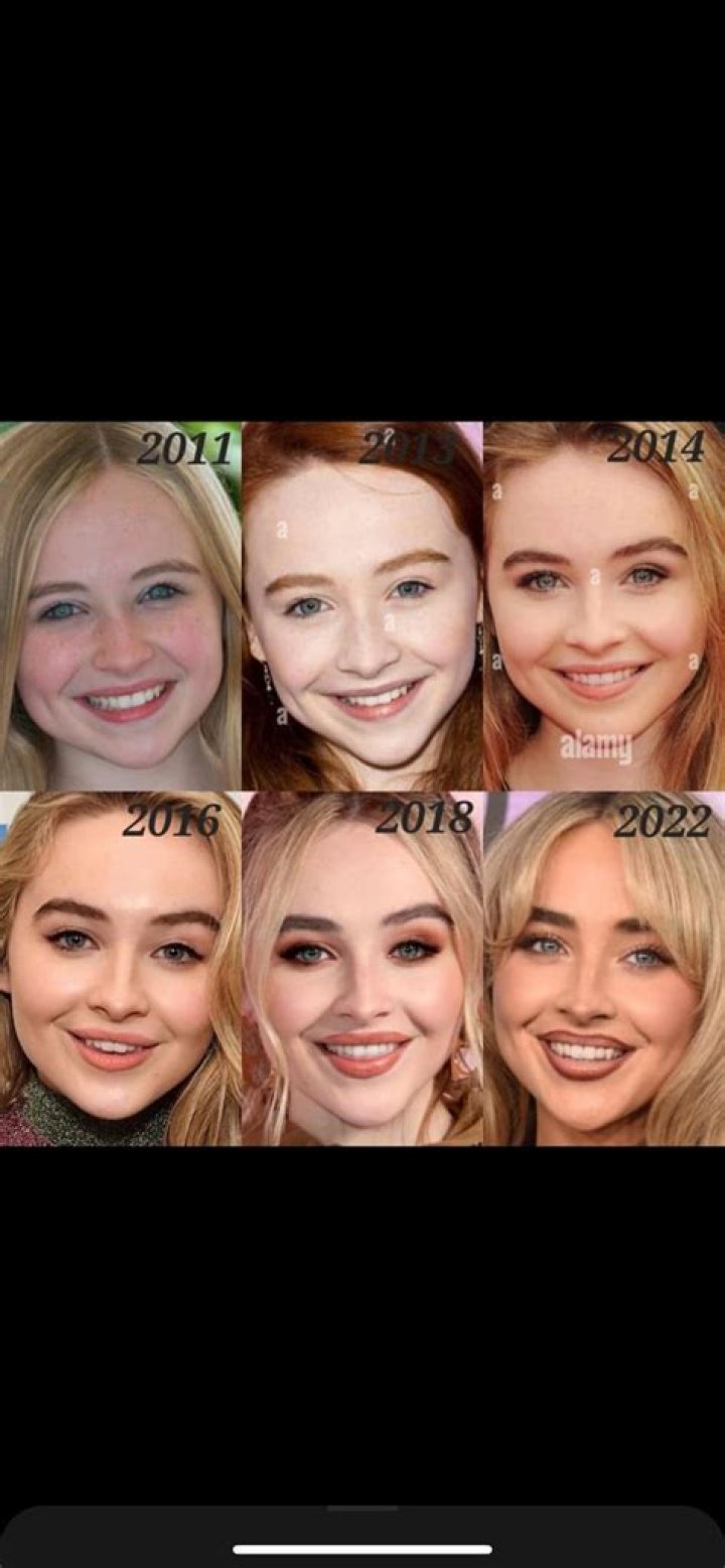 Unveiling The Truth Behind Sabrina Carpenter's Filler Rumors