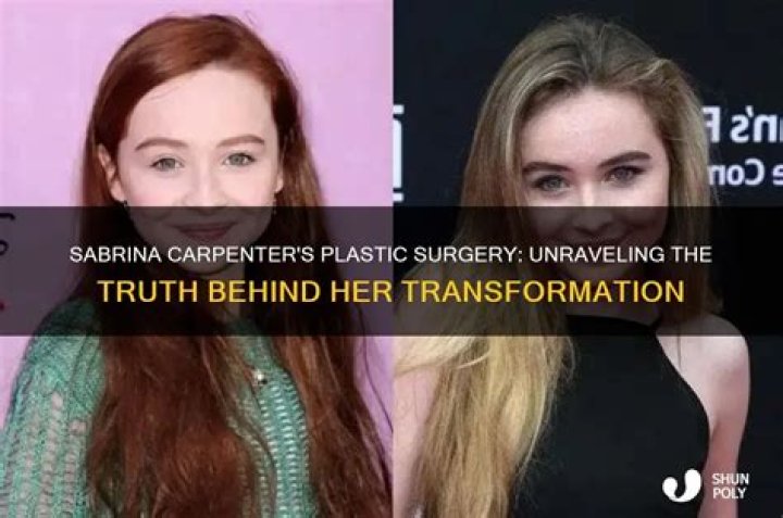 Unveiling The Truth: Did Sabrina Carpenter Get Face Surgery?