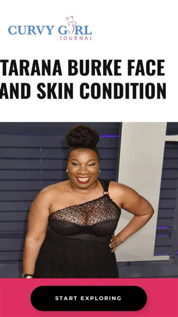 What Happened to Tarana Burke Face? Skin Condition Explained