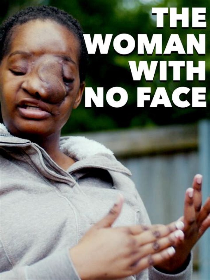 Where Is Tambu Makinzi Now? The Woman With No Face Dead Or Still Alive -Details To Know