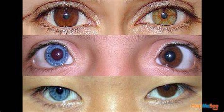 Who Is Pete Hegseth? Des He Have Two Different Colored Eyes