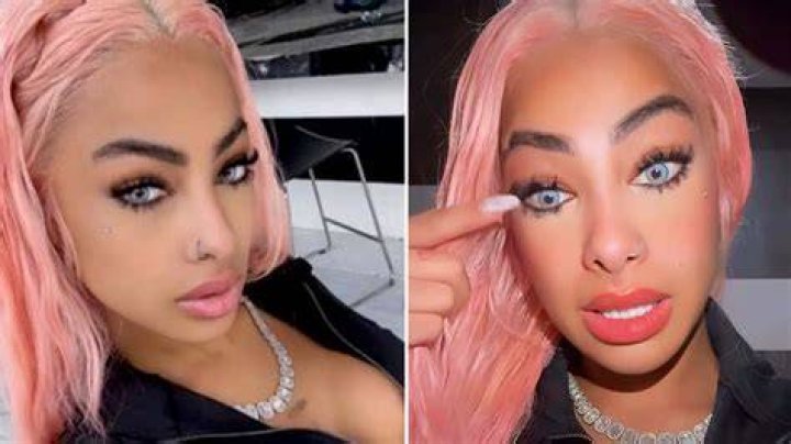 Yailin La Mas Viral Before Surgery Pictures, Did She Get Plastic/Cosmetic Surgery on Her Face?
