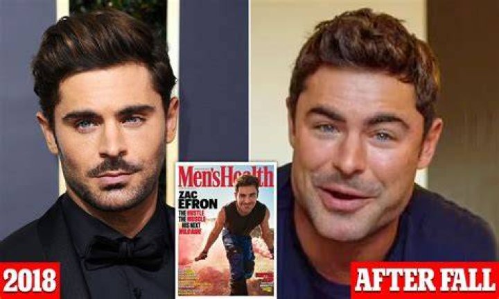 Zac Efron’s New Face: Exploring The Transformation
